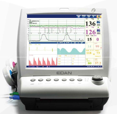 MONITOR FETAL GEMELAR PANTALLA COLOR 12 SOBREMESA EDAN